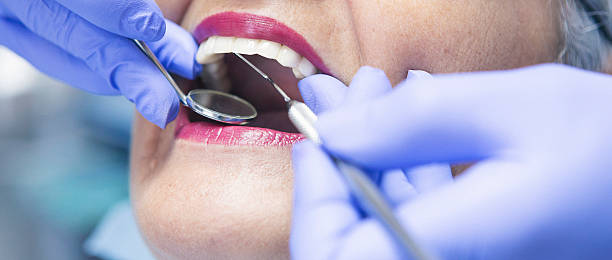 Best Emergency Wisdom Teeth Removal in Pirtleville, AZ